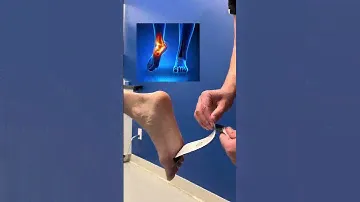 Learn how to tape your foot and calf with Dr.Julian! #spidertech #kinesiologytape #fyp