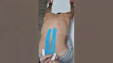 Taping for lower back pain like a pro!